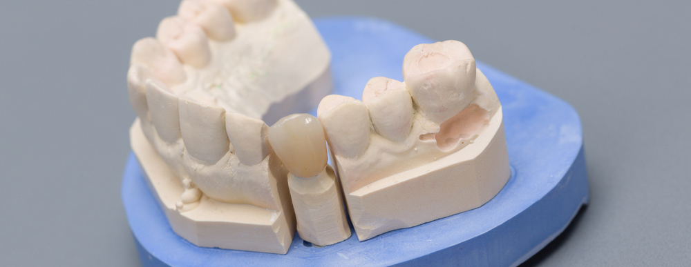 Dentures mold