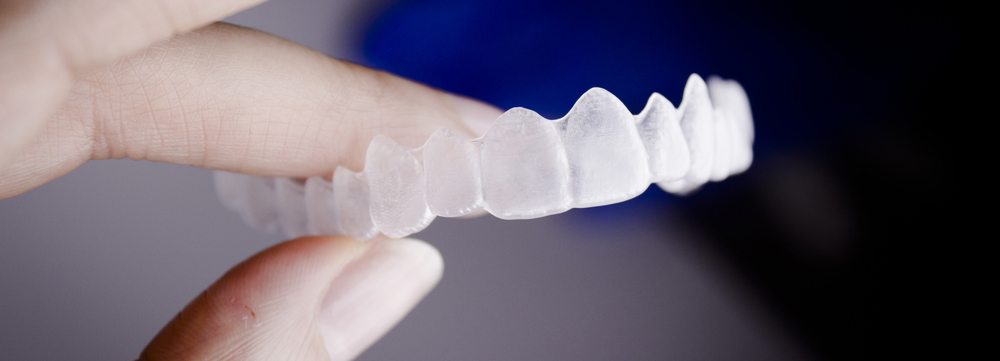 Invisalign in persons hand