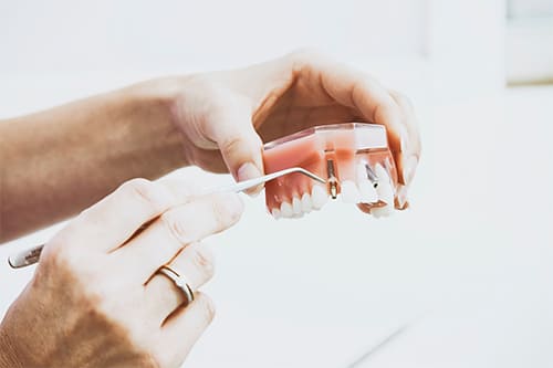 dentures featured service