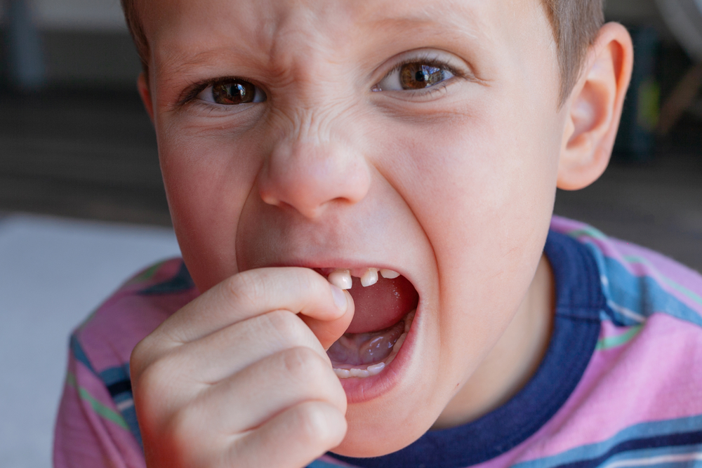 a child wiggling a loose baby tooth