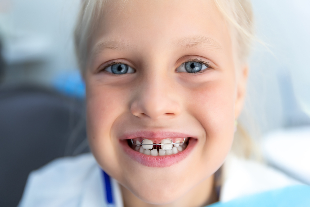 a child with braces to correct large gaps between her front teeth