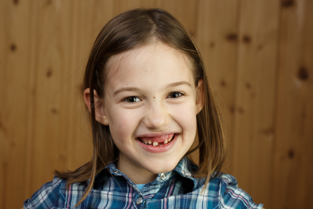 a girl with a space in her front teeth due to a lost baby tooth