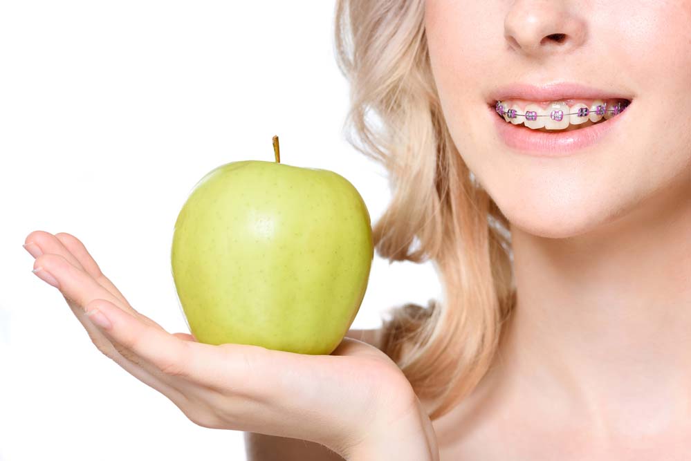 a woman with braces holding a green apple