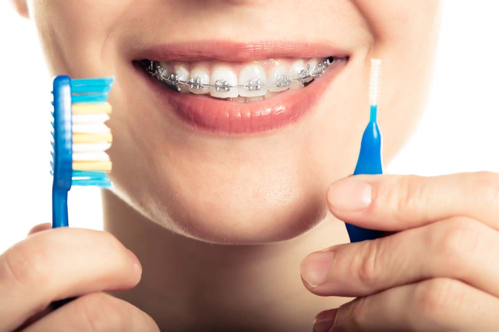 a woman with braces holding up a toothbrush