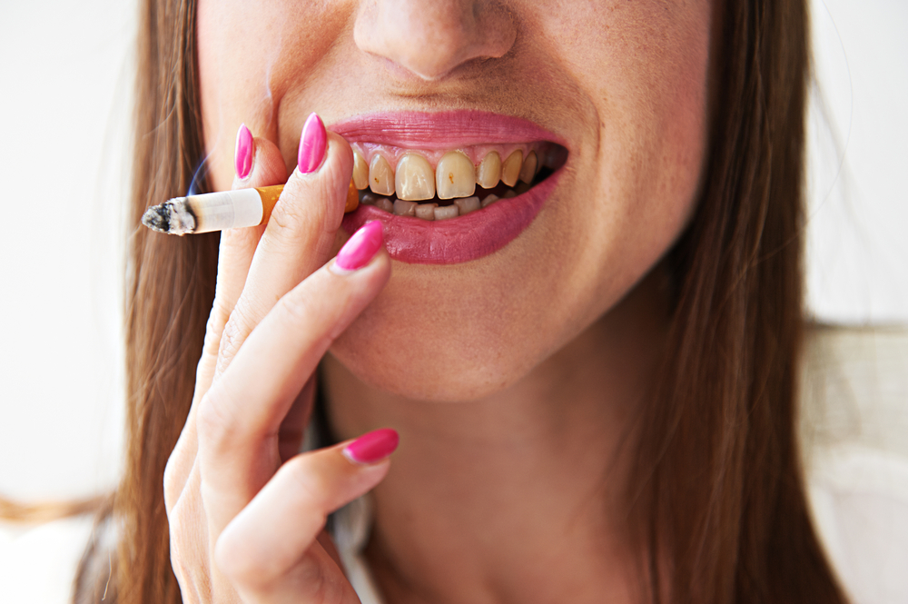 a woman with yellow teeth who is smoking a cigarette