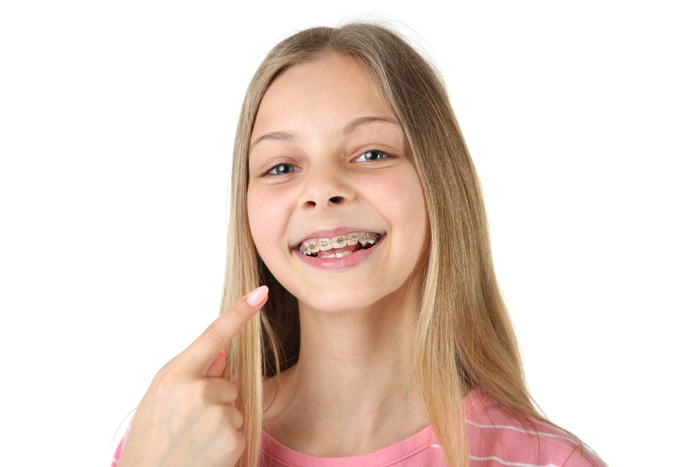 a young teenage girl pointing to the braces on her teeth