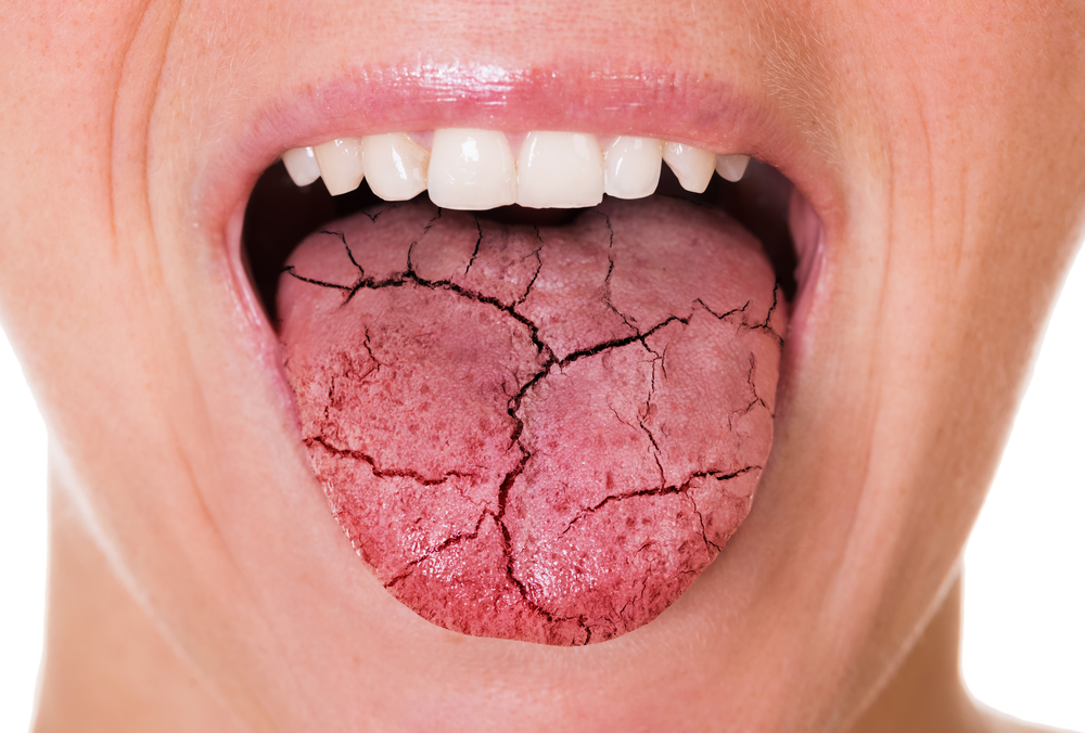 Woman Mouth And Broken Tongue