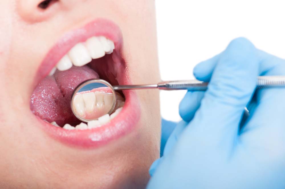 mouth and tongue of a dental patient getting a checkup