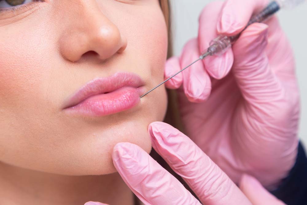 a woman receiving a Juvederm injection into her lip