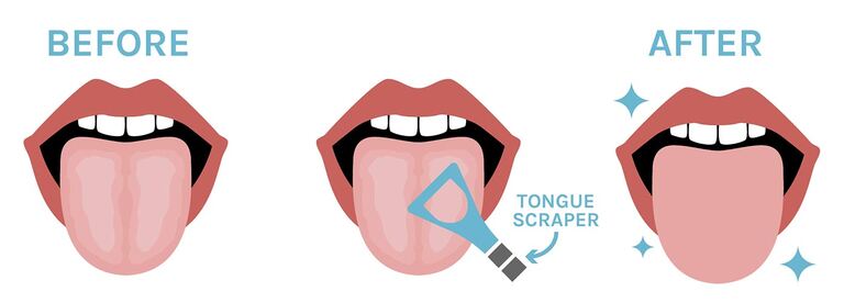 Cleaning your tongue with rinse aids or flossing regularly